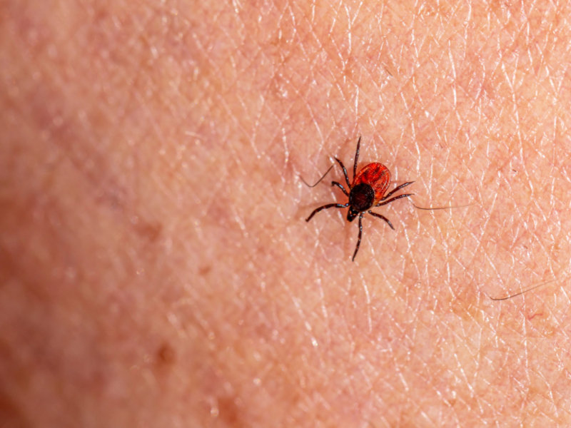 Zecken können verschiedene Krankheiten übertragen - trotz Zeckenspray sollte die Haut immer nach Zecken abgesucht werden